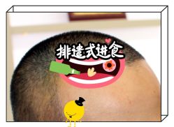 -大麦微针植发全国连锁