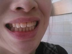 android_upload_pic-岳辰齿科(浦东长泰店)