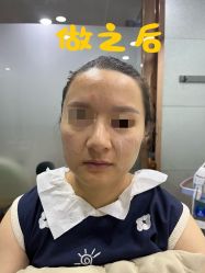 -武汉五洲整形外科医院