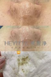 -素妍国际皮肤管理中心