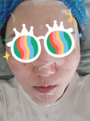 -南京健丽·去眼袋医疗美容机构