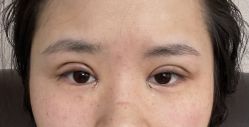 -美莱医学美容医院