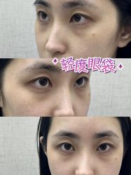 -深圳艺星医疗美容医院