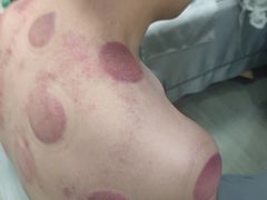 -张钰强中医正骨推拿连锁(唐家人才公寓店)