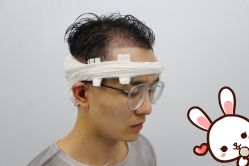 点击看大图 -大麦微针植发丨全国连锁