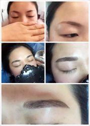 点击看大图 -美肤盾祛痘·问题肌头疗管理中心