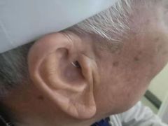 -自然之声助听器(平凉店)