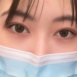 体验后-西安伊美尔医疗美容医院