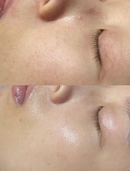 -SKIN79皮肤管理中心