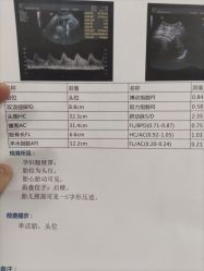 -北京妇产医院(东院)