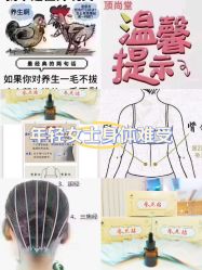 -顶尚堂白发脱发养发