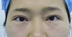 -天津健丽·去眼袋医疗美容机构