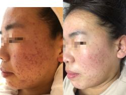-康美贞·痘肌养护管理中心