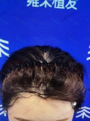 -雍禾植发全国连锁