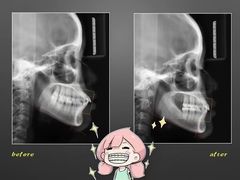 -极光口腔·矫正种植修复(锦江店)