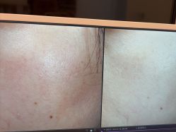 -苑苑vbeauty科技美容SPA