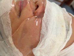 -长沙雅美医疗美容医院