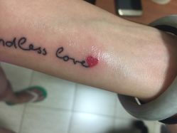 点击看大图 -新肤洗纹身