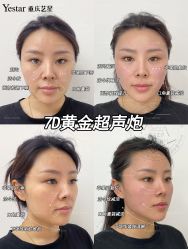 -Yestar重庆艺星医疗美容医院