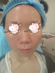 点击看大图 体验后-上海时光整形外科医院