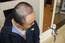 -大麦微针植发丨全国连锁