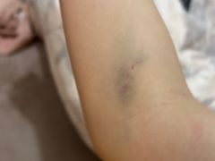 -苏州市立医院(白塔院区)