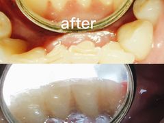 -Dr.Z dental仁康种植矫正中心