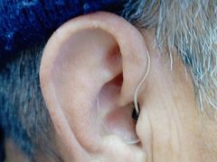 -安湃声助听器(密云店)