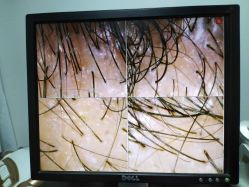 -章光101防脱养发荟