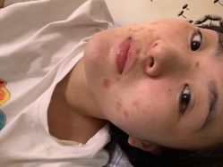 点击看大图 体验后-上海时光整形外科医院
