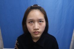 -广州健丽·去眼袋医疗美容机构