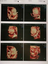 -杭州贝瑞斯美华妇儿医院·早孕·产检·儿科