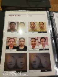 点击看大图 -小颜秘家·韩国整骨