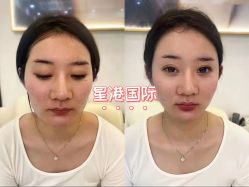 -星港国际·Skin皮肤专研·皮肤管理