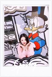 点击看大图 体验后-大麦微针植发全国连锁