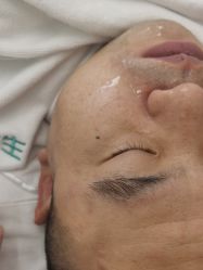 -痘敏医生专业祛痘连锁
