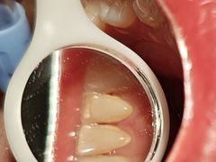 -思诺口腔(牛市口店)