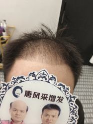 -唐风采假发补发定制