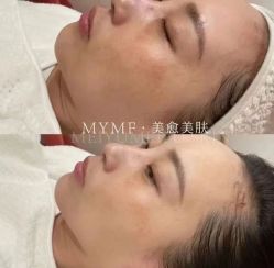 -美愈美肤MEIYU SKIN