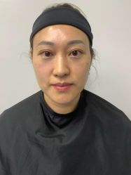-广州健丽·去眼袋医疗美容机构