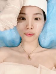 -上海漾颜医疗美容