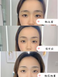 点击看大图 -久匠·纹眉纹绣半永久