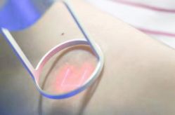 点击看大图 -成都军建医院·疤痕诊疗中心