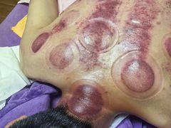 -沈师傅盲人按摩工作室(密三小区店)