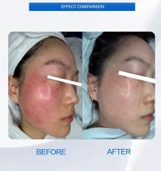 点击看大图 -SOS修丽可.痘肌修复中心