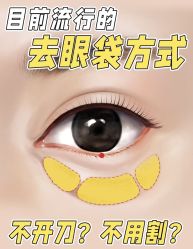 点击看大图 -天津健丽·去眼袋医疗美容机构