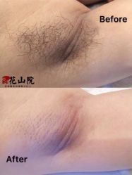 -觅屿日式脱毛美肤