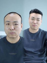-型男帮男士假发补发·佩戴式发型