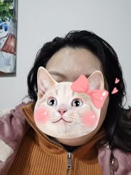 体验后-重庆军科整形美容医院