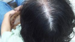 -雍禾植发全国连锁